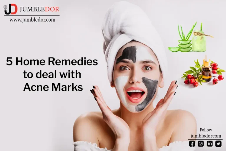 home remedies for acne marks