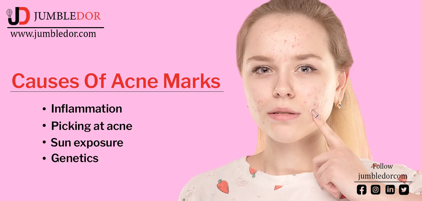 5 home remedies to deal with acne marks | Jumbledor