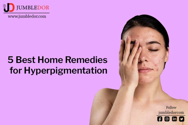 best home remedies for hyperpigmentation